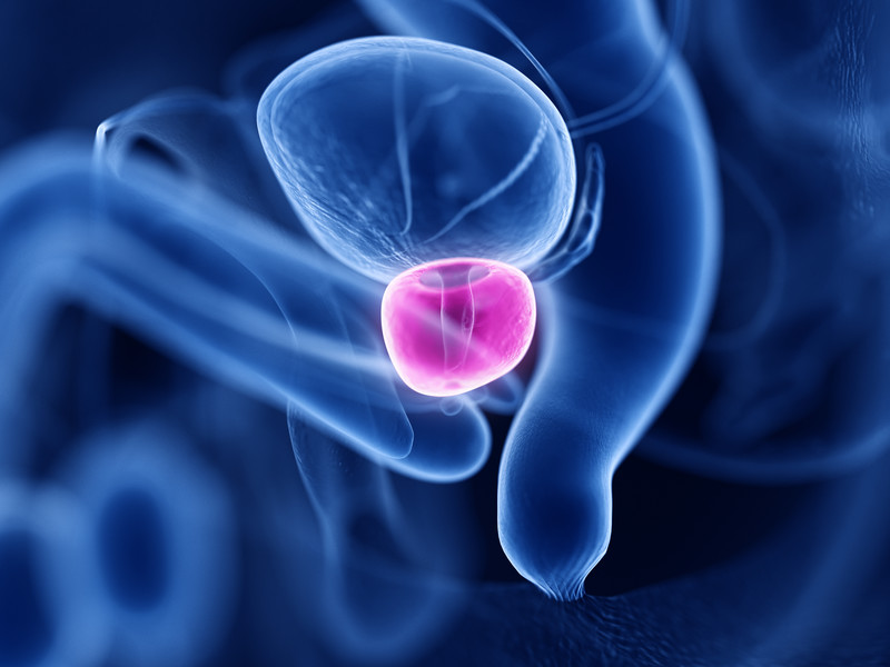 Cancer de la prostate : prévention naturelle et conseils efficaces