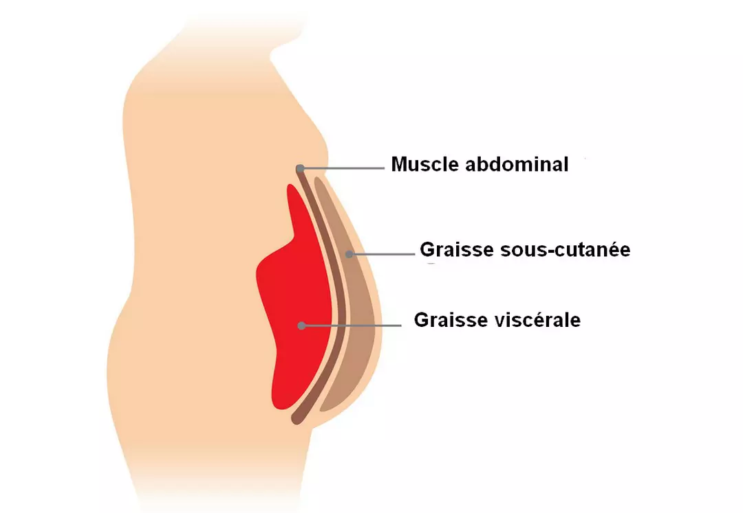 Syndrome métabolique : causes, symptômes et solutions naturelles efficaces